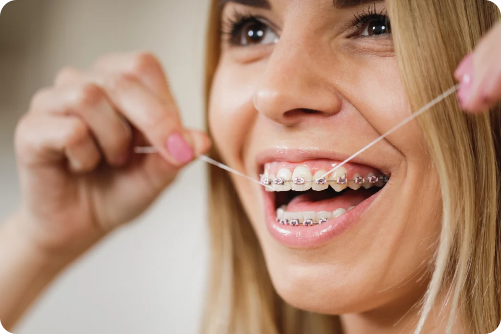Hygiène bucco-dentaire pendant un traitement orthodontique Orthodontiste spécialiste à Paris 18 | Dr Mehdi Sersab