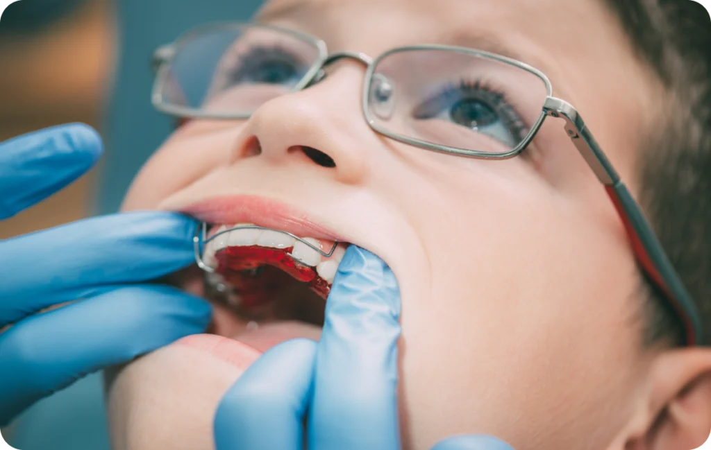Troubles fonctionnels et dysfonctions oro-faciales : l'approche orthodontique globale Orthodontiste spécialiste à Paris 18 | Dr Mehdi Sersab