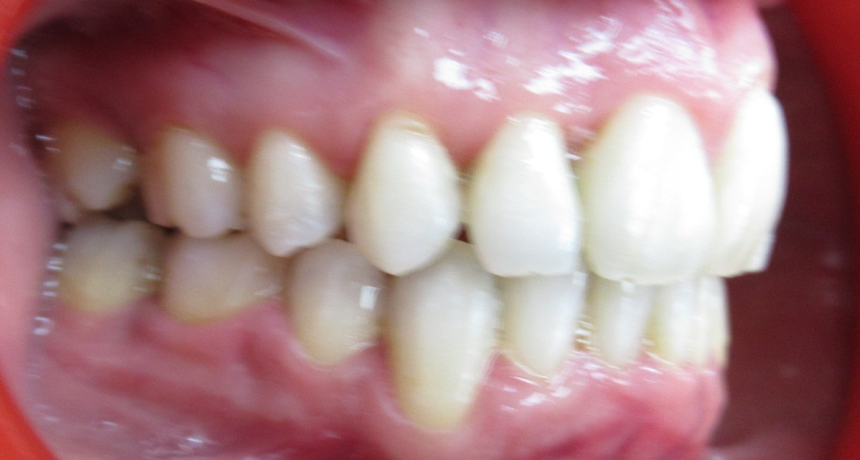 Traitement par appareils dentaires Orthodontiste spécialiste à Paris 18, Dr Mehdi Sersab