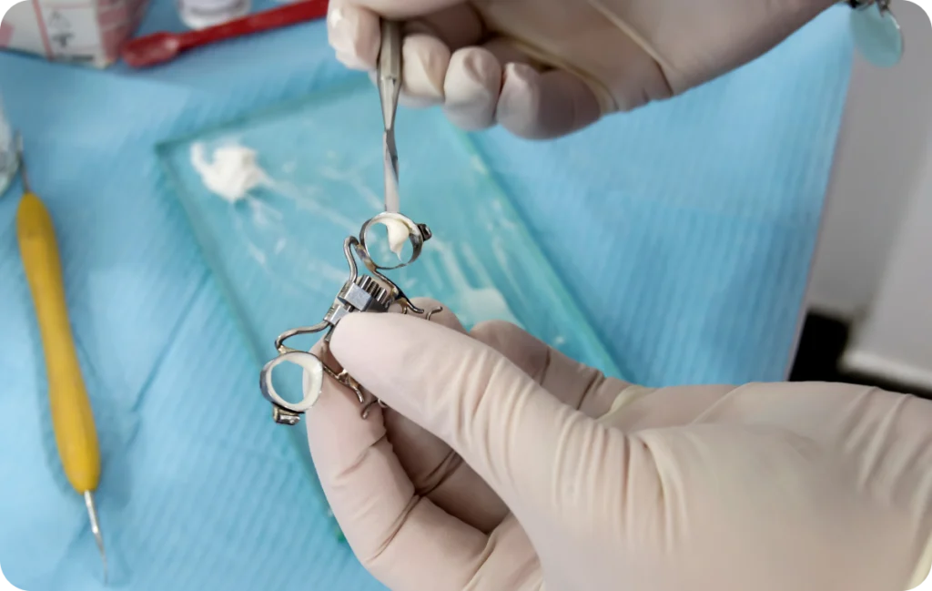 Expansion maxillaire et disjonction palatine chez l’enfant Orthodontiste spécialiste à Paris 18 | Dr Mehdi Sersab
