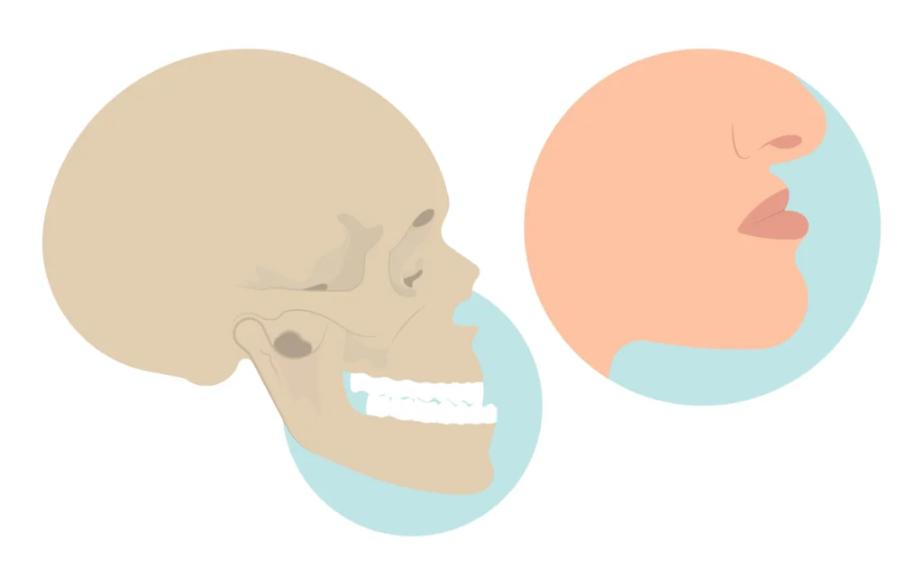 Maladies rares de l'enfant Orthodontiste spécialiste à Paris 18 | Dr Mehdi Sersab