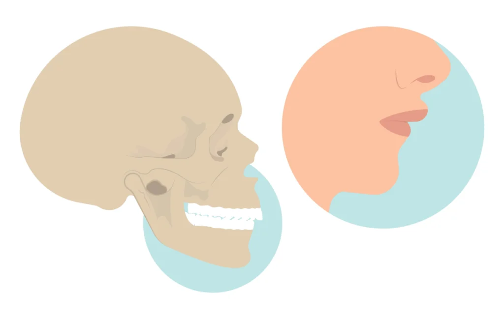 Maladies rares de l'enfant Orthodontiste spécialiste à Paris 18 | Dr Mehdi Sersab